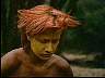 jaw14.jpg
